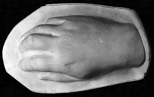 Plaster Cast of the Artist's Hand